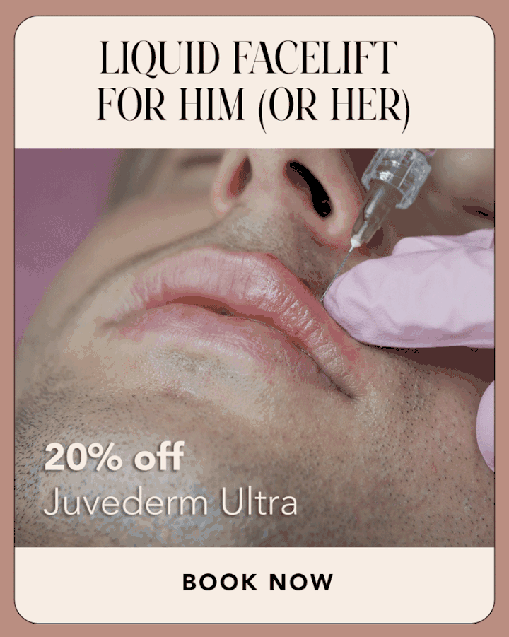 Juvederm Ultra filler special at Beauty Ranch med spa Brentwood Los Angeles
