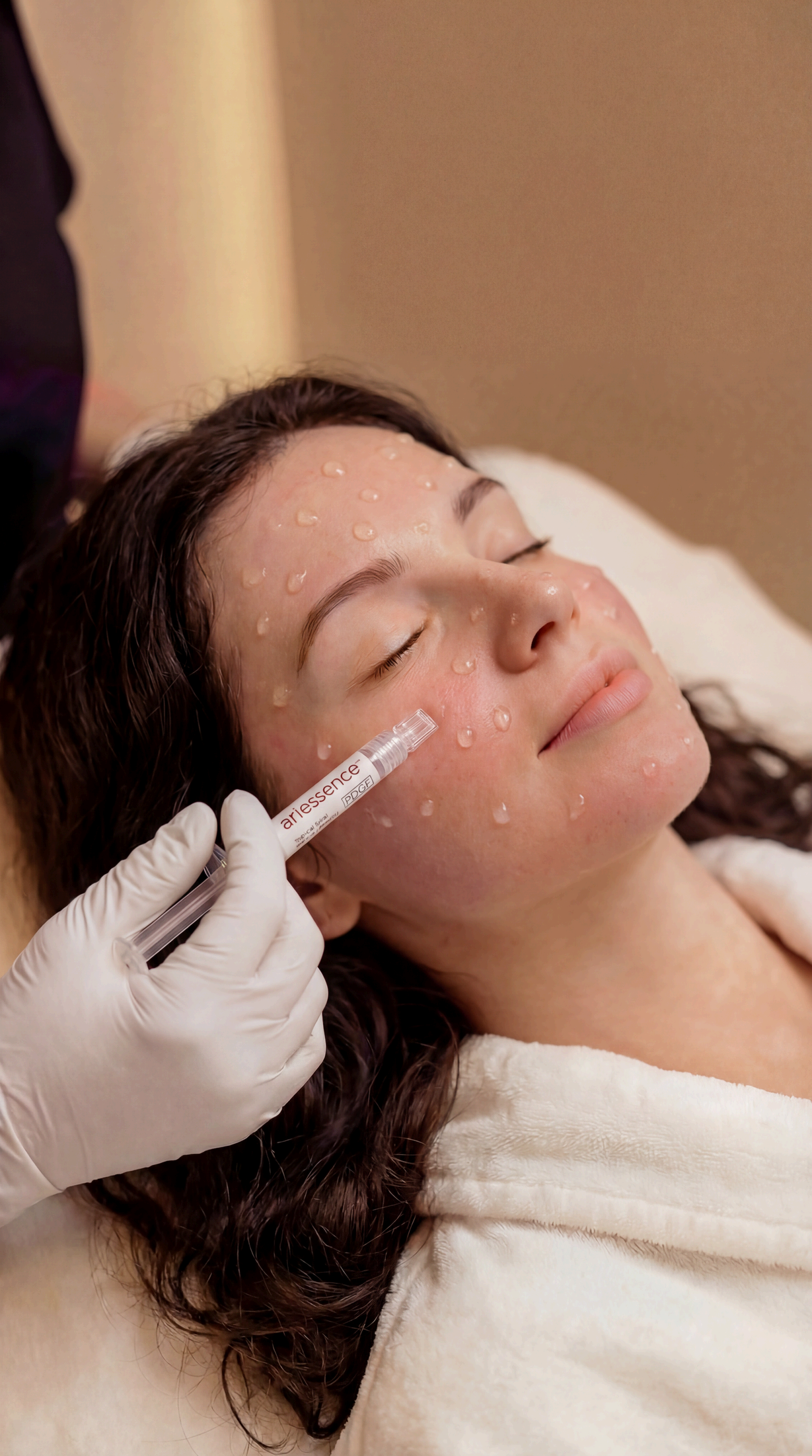 Ariessence PDGF+ treatment