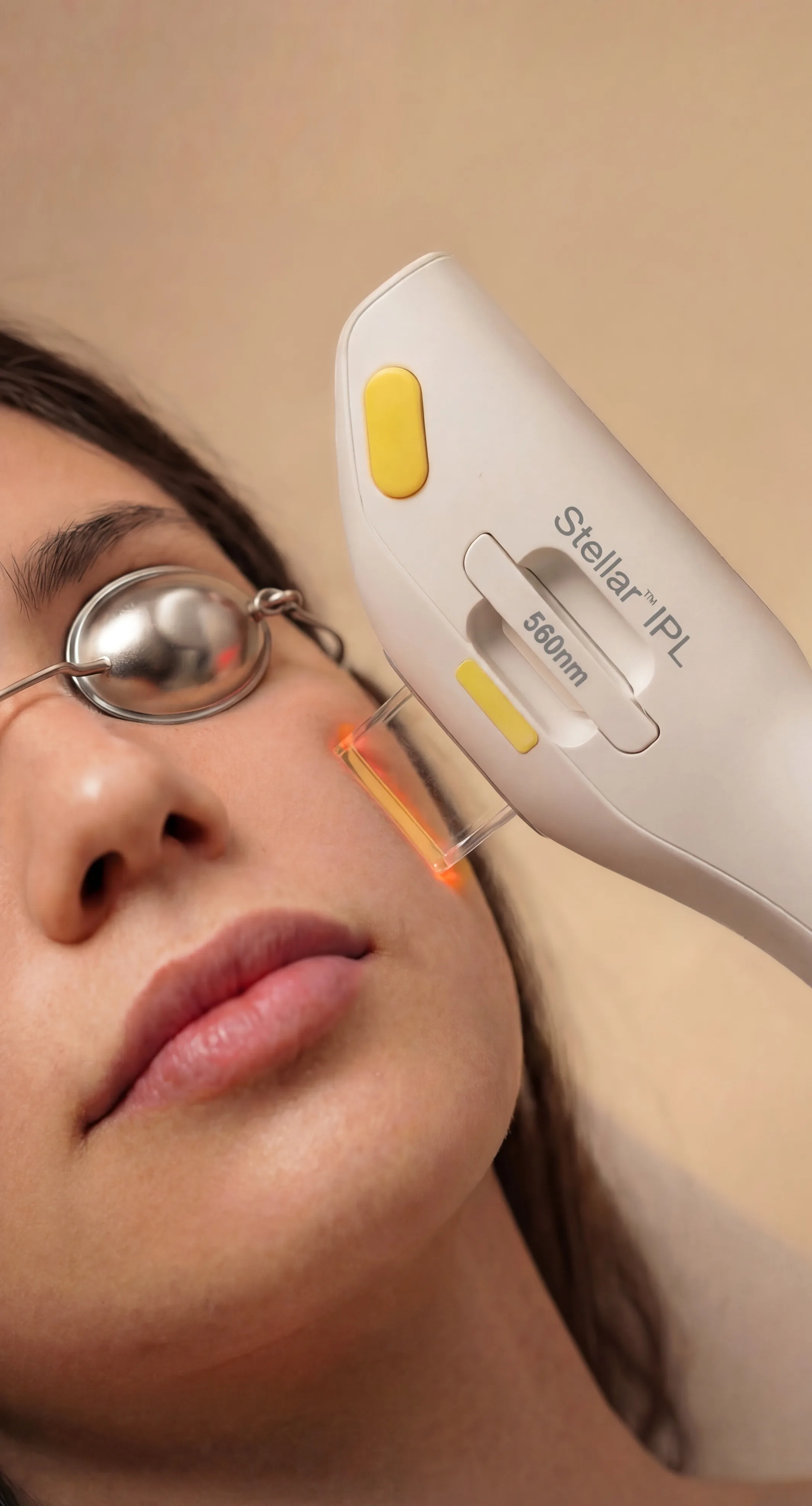 M22 IPL treatment detail at Beauty Ranch Medical Spa